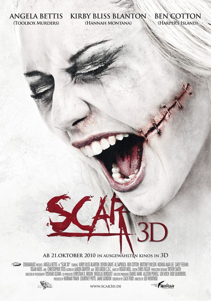 Scar