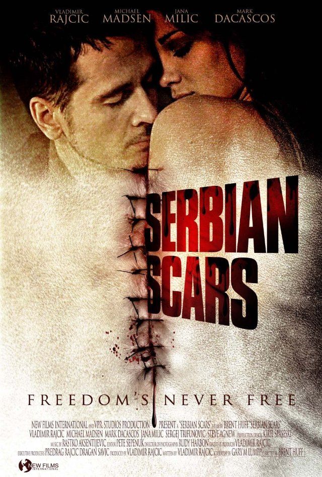 Serbian Scars